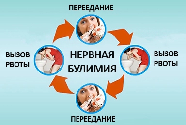 Лечение булимии в Началово
